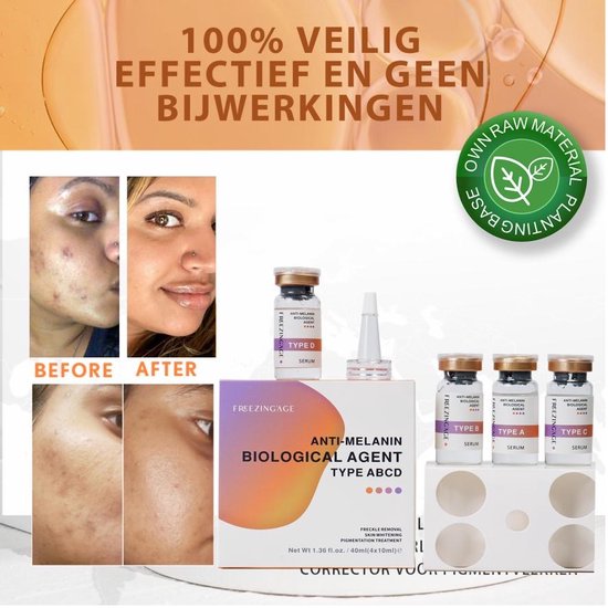 Freezing'Age Anti-Melanine Serum - Huidverzorging Pigmentvlekken - Pigmentvlekken Verwijderen - Hyperpigmentatie Donkere vlekken - 4x 10ml