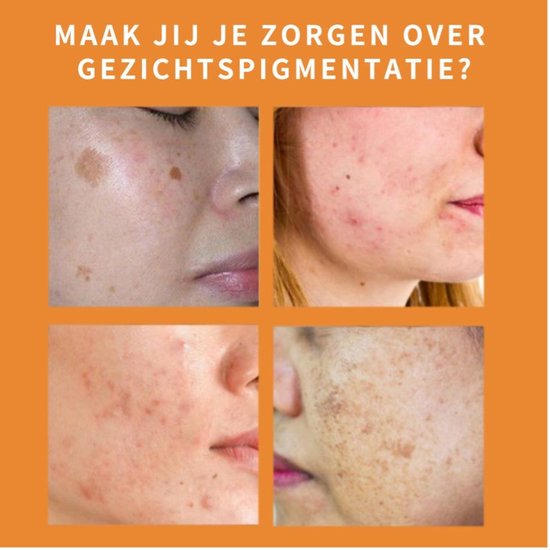 Freezing'Age Anti-Melanine Serum - Huidverzorging Pigmentvlekken - Pigmentvlekken Verwijderen - Hyperpigmentatie Donkere vlekken - 4x 10ml