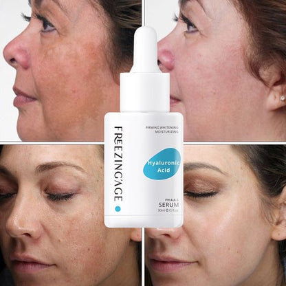Freezing'Age Hyaluronzuur Serum - Anti-aging Gezichtsserum - Hyaluronic Acid - 30 ml.