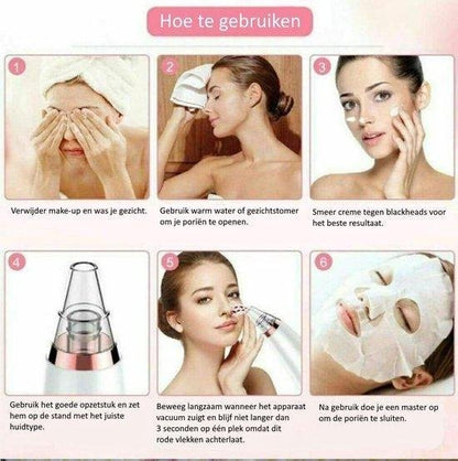 Uitleg hoe je een BlackHead Remover gebruikt