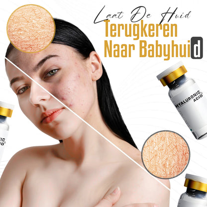 Hyaluronzuur Serum - Hyaluronic Acid - Anti Aging Hydraterende Serum - 40 ml.